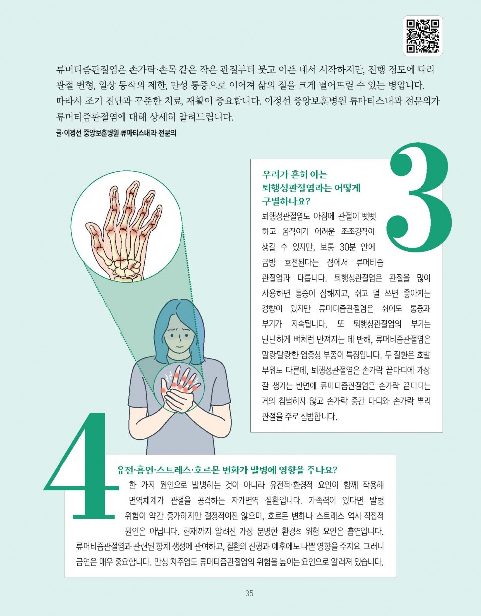 관절을 괴롭히는 만성 염증, 류머티즘관절염